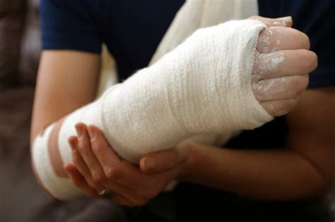 5 Things You Cant Do With A Broken Wrist