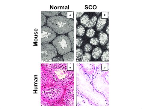 A Comparison Of The Testicular Histology Of Control A And Treated