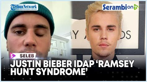 Separuh Wajah Justin Bieber Lumpuh Rangkaian Konsernya Terpaksa