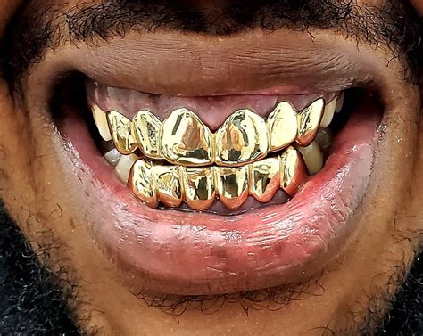 K Gold Grillz Smirkgoldgrillz