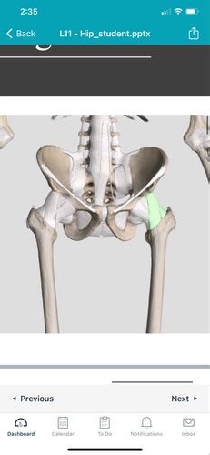 Hip Joint Lecture Flashcards Quizlet