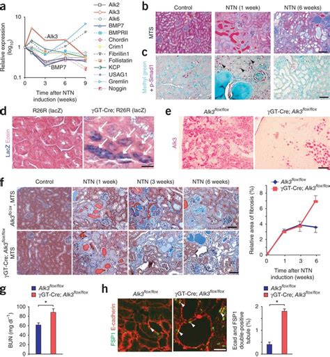 Alk3 And BMP7 Expression Inversely Correlate In Kidneys Developing