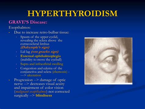 Ppt Thyroid Powerpoint Presentation Free Download Id291173