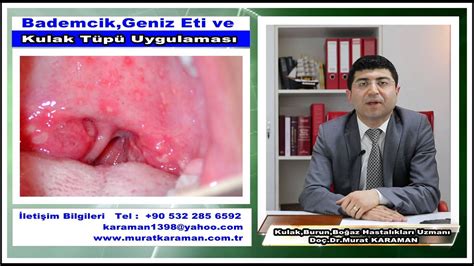 Bademcik Geniz Eti Ve Kulak T P Master Do Dr Murat Karaman Youtube