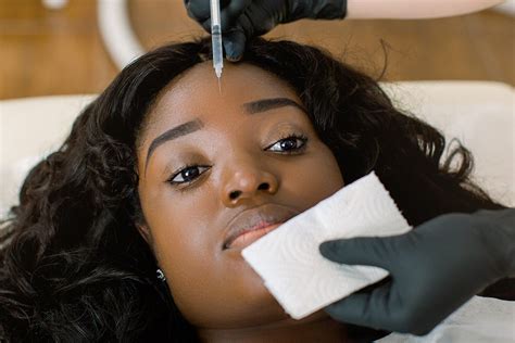 Mesotherapy Treatment — Black Skin Directory