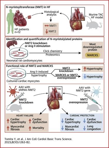 Targeting N Myristoylation Through NMT2 Prevents Cardiac Hypertrophy