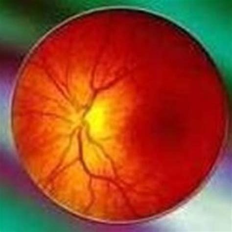 Diabetic Eye Screening Easy Read Seeability