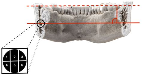 Diagnostics Free Full Text Mandibular Third Molar Surgery