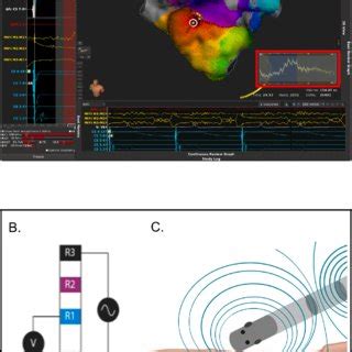 Moderate Positive Correlation Of Local Impedance And Corresponding