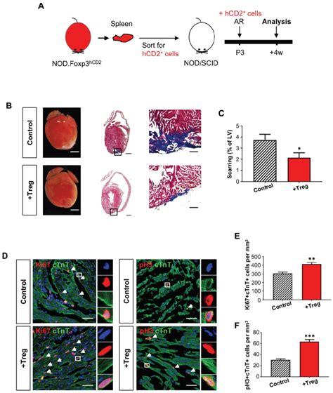 Adoptive Transfer Of Foxp Treg Leads To Reduced Fibrosis Of The