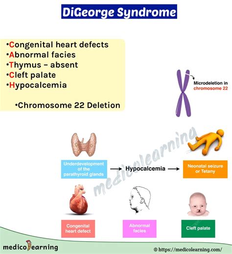 Digeorge Syndrome Medicolearning