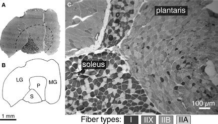 Anatomical Location And Fiber Types Present In Mouse Soleus And