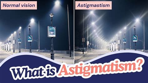 What Is Astigmatism Understanding Causes Symptoms And Treatments