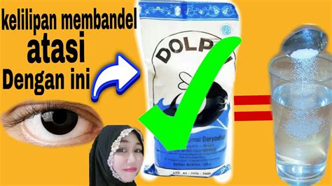 TUTORIAL CARA MENGATASI MATA KELILIPAN YANG MEMBANDEL YouTube