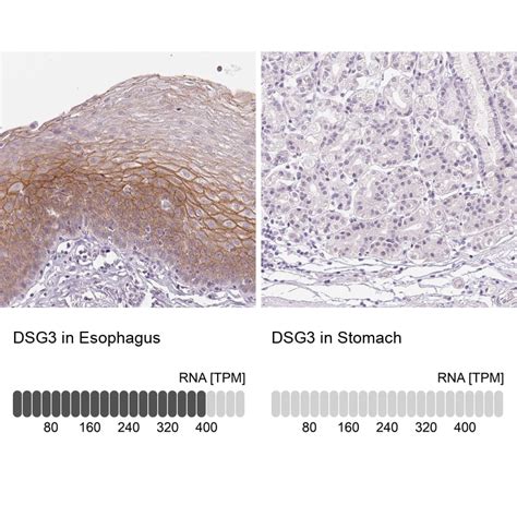 Desmoglein 3 Antibody (PA5-84316)