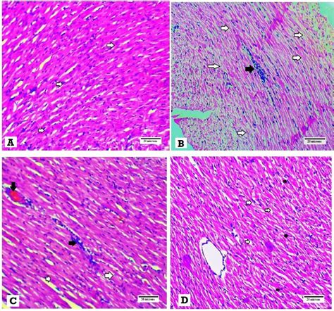 Histopathological Examination Of The Heart Tissues Stained With H E