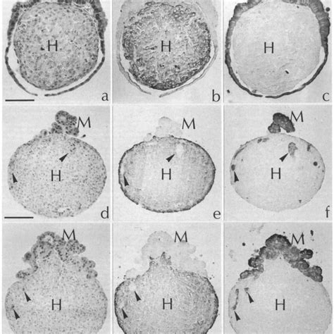 Invasion Of Chick Heart Tissue After Treatment Of MDCK Cells With