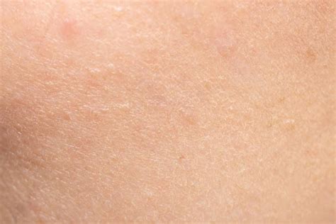 5 Signs Your Skin Is Dehydrated And How To Fix It Ultima Ii