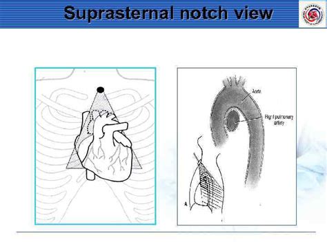 Standard Imaging Of Transthoracic Echocardiography Terminology A