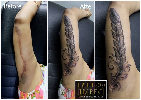 50 Times People Asked To Cover Up Their Scars And This Tattoo Artist Nailed It New Pics Artofit