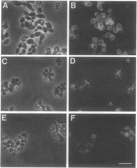 Fluorescence And Phase Contrast Micrographs Of Wildtype And Download Scientific Diagram