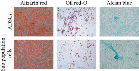 Proliferation And Trilineage Differentiation Potential Between Adscs Download Scientific