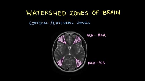 Watershed zones of brain #shorts #Shorts - YouTube