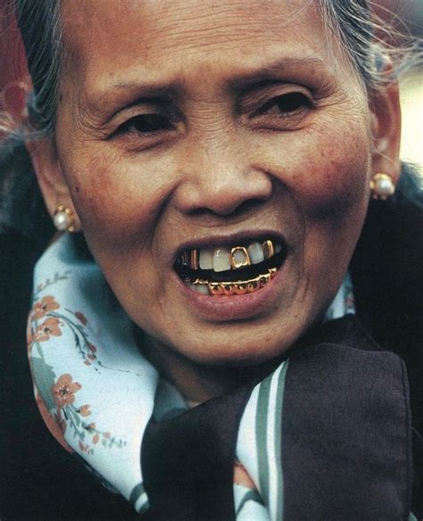 Grillz teeth, Grillz, Grills teeth