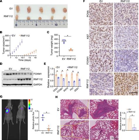 Jci Insight Rnf Mediated Foxm Ubiquitination Suppresses The