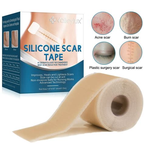 Valleylux 60 Inch Silicone Scar Sheet Professional Silicone Scar Tape Roll For C Section