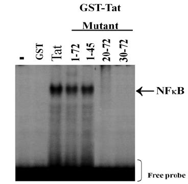 Activation Of NF B By HIV 1 Tat 1 45 In Human Monocytes The