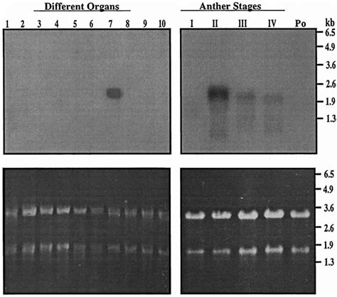 RNA Blot Hybridizations Of Xyl MRNAs In Maize Organs The Upper Panels