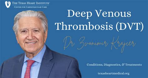 Deep Vein Thrombosis Dvt The Texas Heart Institute