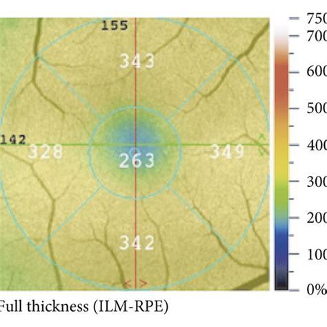 Boxplots Of The Foveal Avascular Zone Area A Perimeter B Download Scientific Diagram