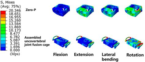 Frontiers Biomechanical Performance Of The Novel Assembled