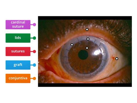 cornea - Labelled diagram