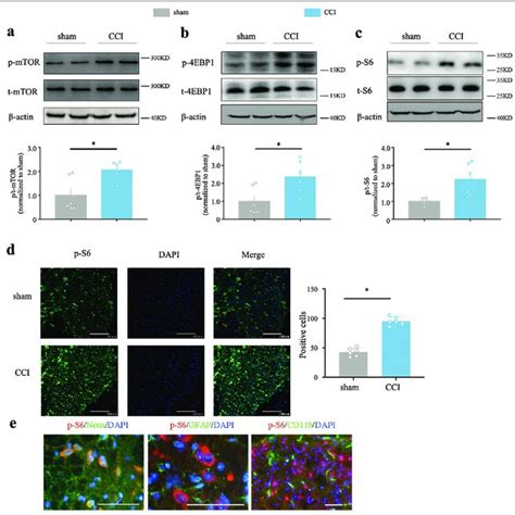 Rheb Induced Activation Of Mtorc In Neuropathic Pain And Block The