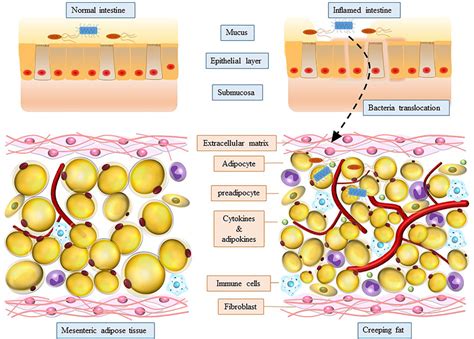 Bacteria Translocation And Components In Creeping Fat Crf Download