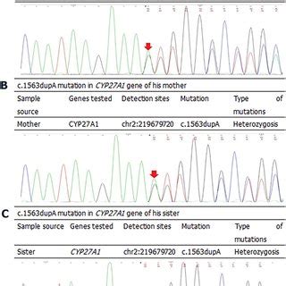 C Dupa Mutation In Cyp A Gene Of Patient And His Families A