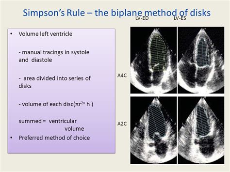 EVALUATION OF SYSTOLIC FUNCTION OF LEFT VENTRICLE BY ECHOCARDIOGRAPHY