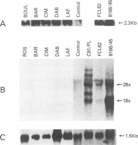 DNA And RNA Analysis Of TSP HAM PBMCs And Chronically HTLV I Infected