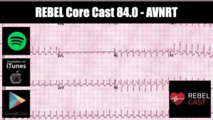 Rebel Core Cast Avnrt Rebel Em Emergency Medicine Blog