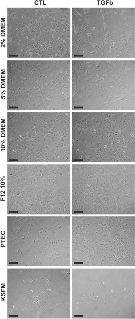 HK 2 细胞对 TGF β 的反应高度依赖于细胞培养基配方 Histochemistry and Cell Biology X MOL