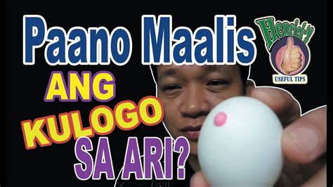 Paano Maaalis Ang Kulogo Sa Ari How To Remove Genital Warts Free