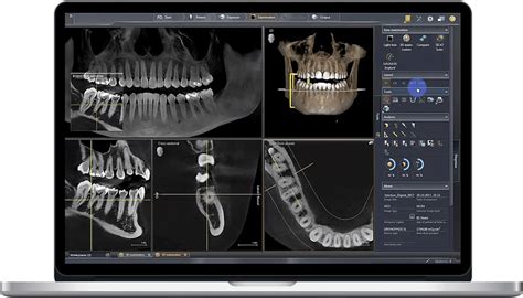 CBCT Dental Scanning, Houston, TX