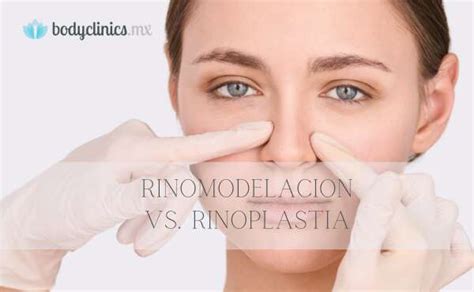 Rinoplastia Vs Rinomodelación