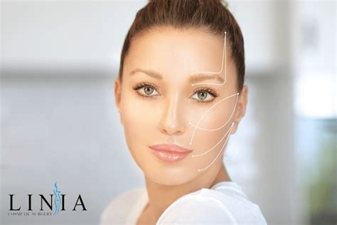 Benefits Of Facelift Surgery Linia Cosmetic Surgery