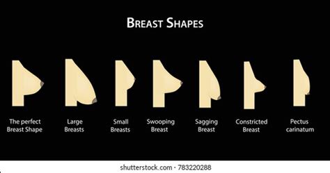 Different Breast Shapes Chart Nbkomputer