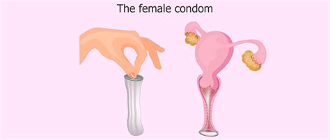 How To Use Internal Condoms Follow Easy Instructions