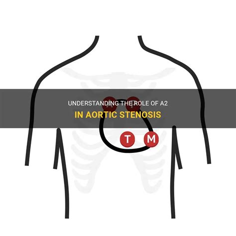 Understanding The Role Of A2 In Aortic Stenosis MedShun